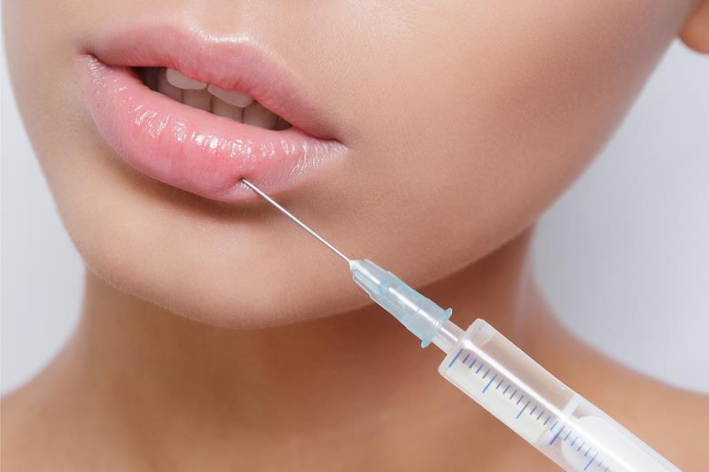 Dermal lip filler treatment