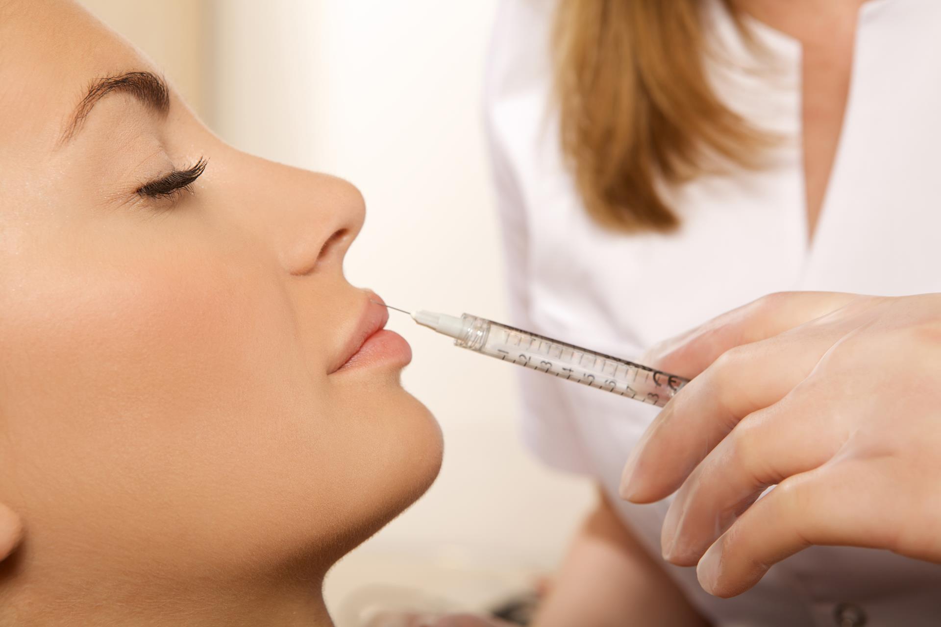 Dermal lip filler treatment